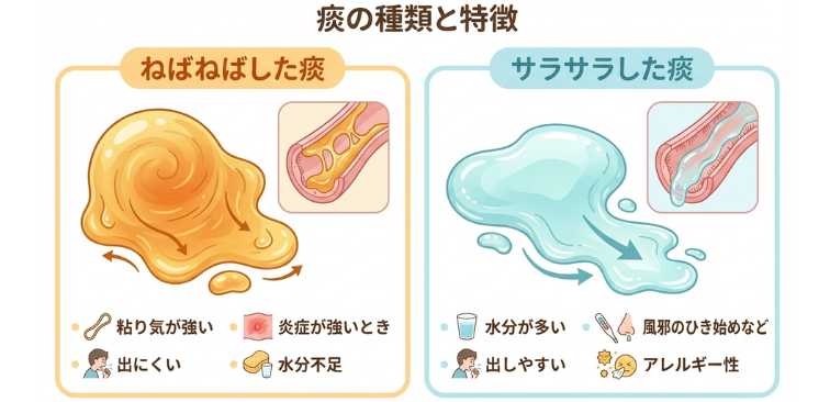 粘り気の多い痰、サラサラした痰の比較図解
