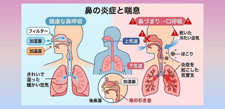 鼻の炎症と喘息の関わりを示した図解