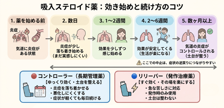 吸入ステロイドの効果が出るまでの目安の流れとリリーバー・コントローラーの特性を示した図解