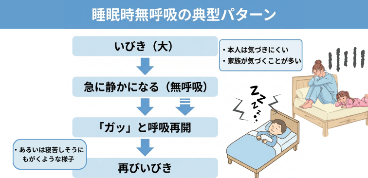 睡眠時無呼吸の典型的なパターンのフローチャート