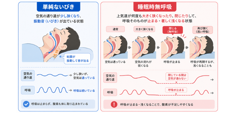 いびきと睡眠時無呼吸の違いを示した図解