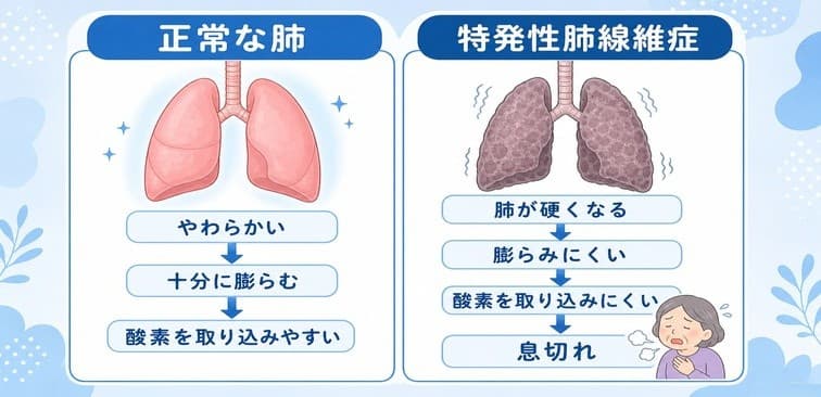正常な肺と線維化した肺の違い