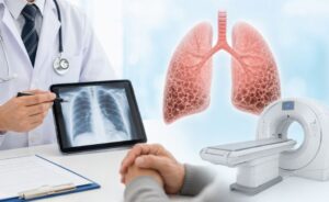特発性肺線維症の疑いがある方へ医師が説明をしている様子