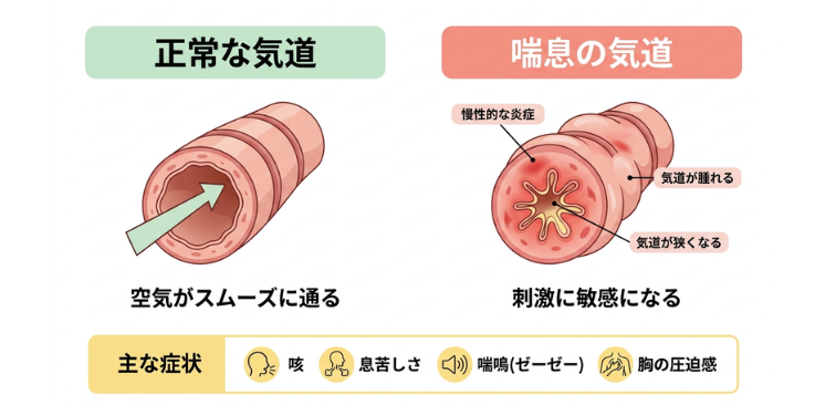 正常な気道と炎症のある気道の違い