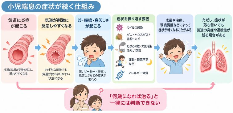 小児喘息の症状が続く仕組みの図解