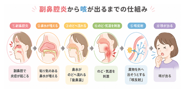 副鼻腔炎から咳が出る仕組み